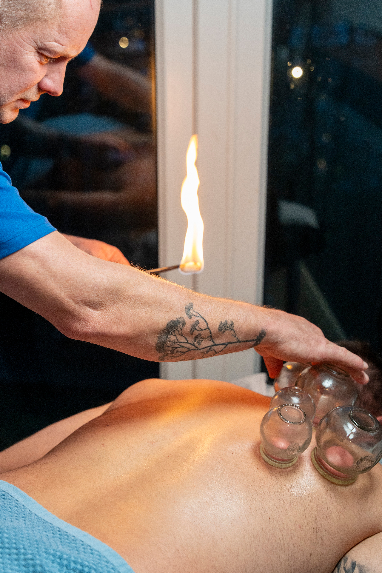 Professional cupping therapy treatment